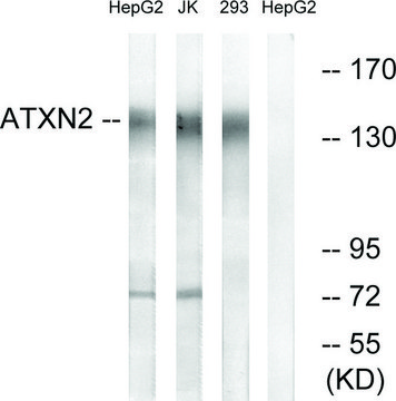 Anti-ATXN2 antibody produced in rabbit