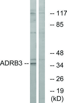 Anti-ADRB3 antibody produced in rabbit