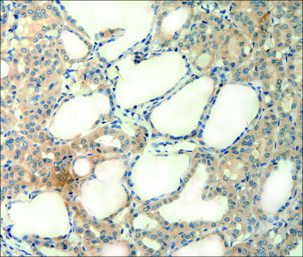 Anti-AGRN antibody produced in rabbit