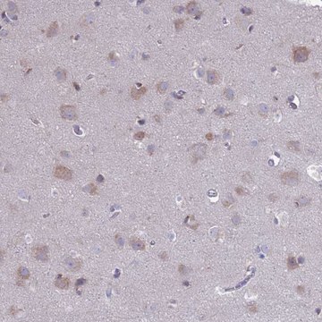Anti-PET117 antibody produced in rabbit