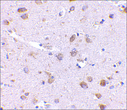 Anti-SATB1 (ab1) antibody produced in