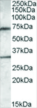 Anti-Endothelial Lipase antibody produced in