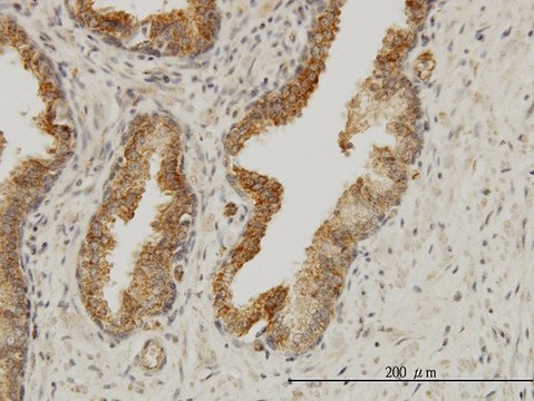 Monoclonal Anti-AAAS antibody produced in