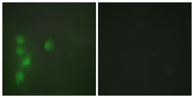 Anti-ZNF174 antibody produced in rabbit