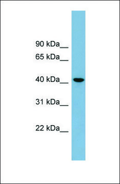 Anti-B4GALT2 antibody produced in rabbit