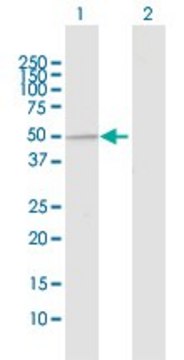 Anti-UBE3C antibody produced in rabbit
