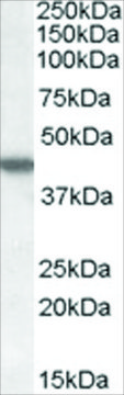Anti-CSNK1E antibody produced in goat