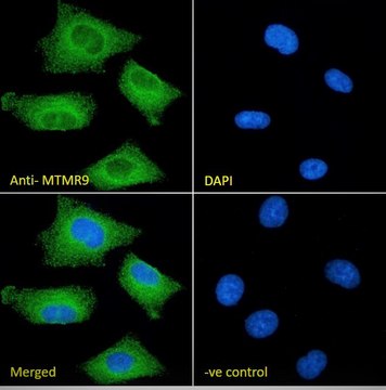 Anti-MTMR9 (C-terminal) antibody produced in