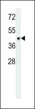 ANTI-CF150 (CENTER) antibody produced in