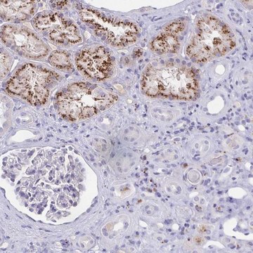 Anti-FAM219B antibody produced in rabbit