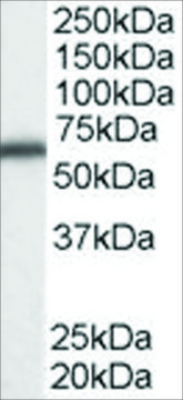 Anti-DDX5/P68 RNA helicase antibody produced