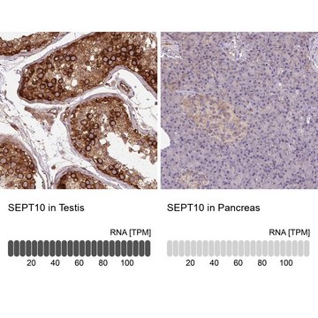 Anti-SEPT10 antibody produced in rabbit