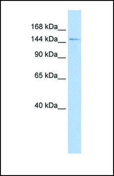 Anti-HISPPD1 antibody produced in rabbit