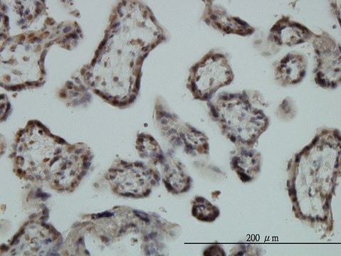 Monoclonal Anti-EGR1 antibody produced in