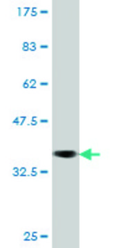 Monoclonal Anti-EXO1, (C-terminal) antibody produced