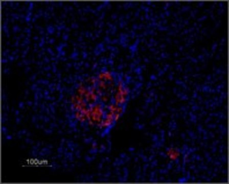 Anti-Potassium Channel K?2.1 (DRK1) antibody