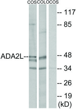 Anti-ADA2L antibody produced in rabbit