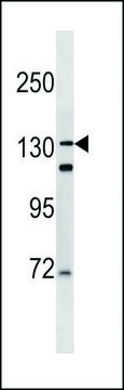 ANTI-DSPP (N-TERM) antibody produced in
