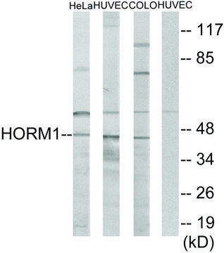 Anti-HORMAD1 antibody produced in rabbit