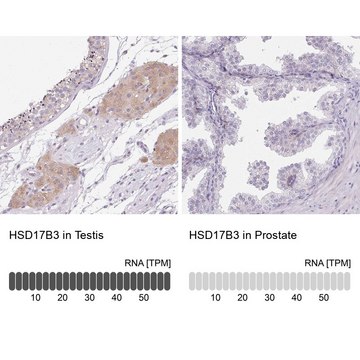 Anti-HSD17B3 antibody produced in rabbit
