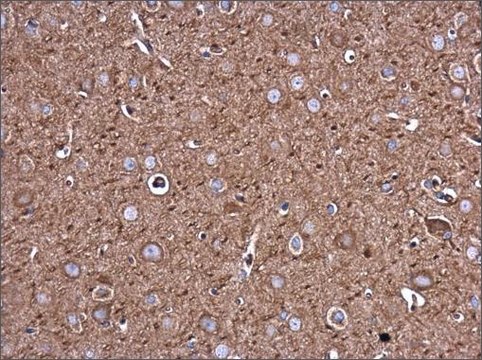 Monoclonal Anti-Filamin B antibody produced