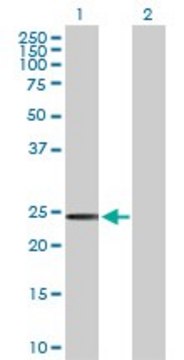 Anti-SSPN antibody produced in rabbit