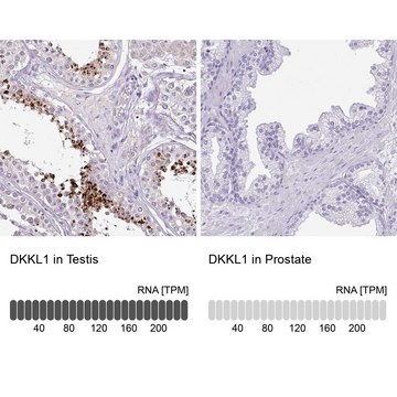 Anti-DKKL1 antibody produced in rabbit