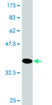 Monoclonal Anti-PYGM, (C-terminal) antibody produced