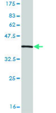 Monoclonal Anti-SUPT16H antibody produced in