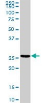 Anti-TNNI2 antibody produced in rabbit