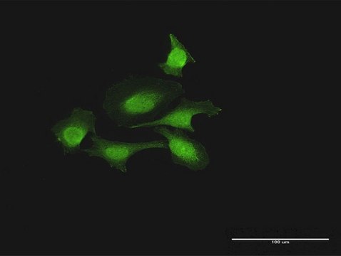 Anti-FOXJ2 antibody produced in rabbit