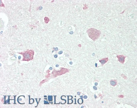 Anti-Neuroserpin antibody produced in goat