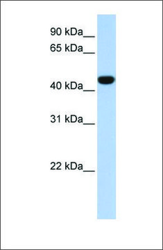 Anti-IDH1 (ab1) antibody produced in