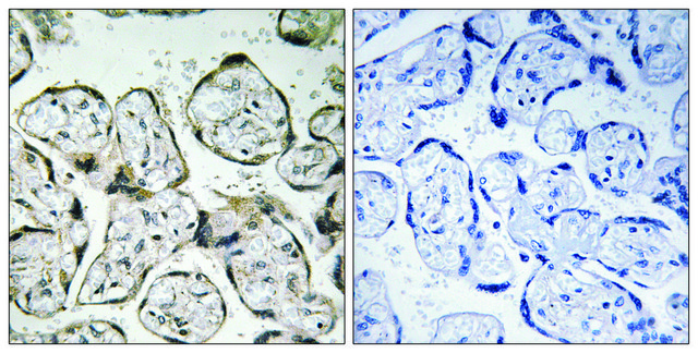 Anti-MT-ND1 antibody produced in rabbit