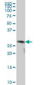 ANTI-TGIF2 antibody produced in mouse