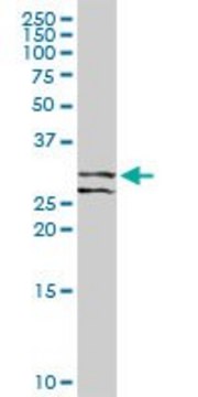 Anti-RCHY1 antibody produced in rabbit
