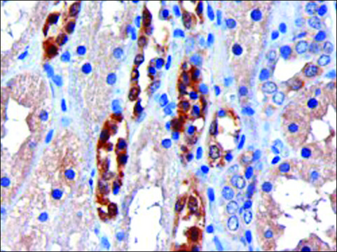 Anti-CBR1 antibody produced in goat