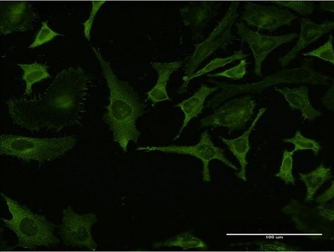 Monoclonal Anti-RPL32 antibody produced in