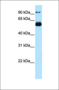 Anti-ETS2 (ab1) antibody produced in