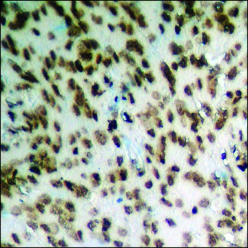 Anti-phospho-HDAC2 (pSer³??) antibody produced in