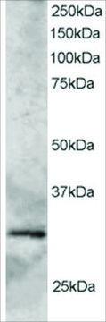Anti-GCIP-Interacting Protein P29 antibody produced