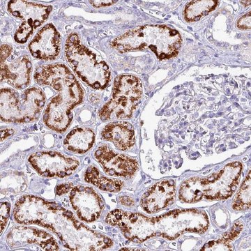 Anti-HSD3B7 antibody produced in rabbit