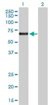 Anti-ACD antibody produced in rabbit
