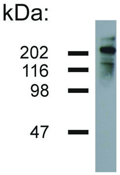 Monoclonal Anti-Neurofilament H antibody produced