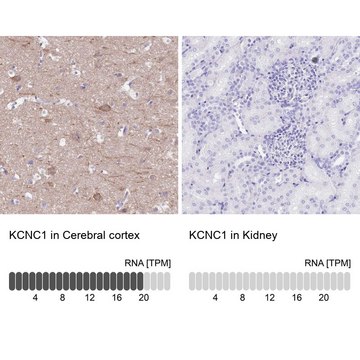 Anti-KCNC1 antibody produced in rabbit