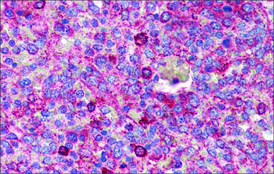 Anti-BCL11A antibody produced in rabbit