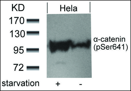 Anti-phospho-CTNNA1 (pSer??¹) antibody produced in