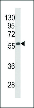 ANTI-BECLIN1-BH3 DOMAIN antibody produced in