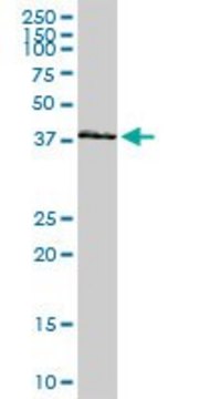 Anti-HOXA11 antibody produced in rabbit