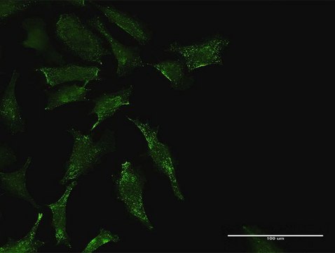 Anti-TEX264 antibody produced in rabbit